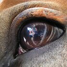 Eye